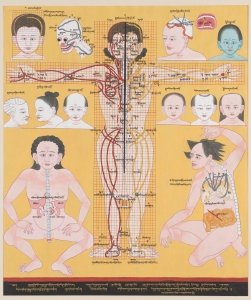 Causes of Illness: A Medical Artwork