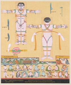Thangka Depicting Bloodletting and Moxibustion Techniques